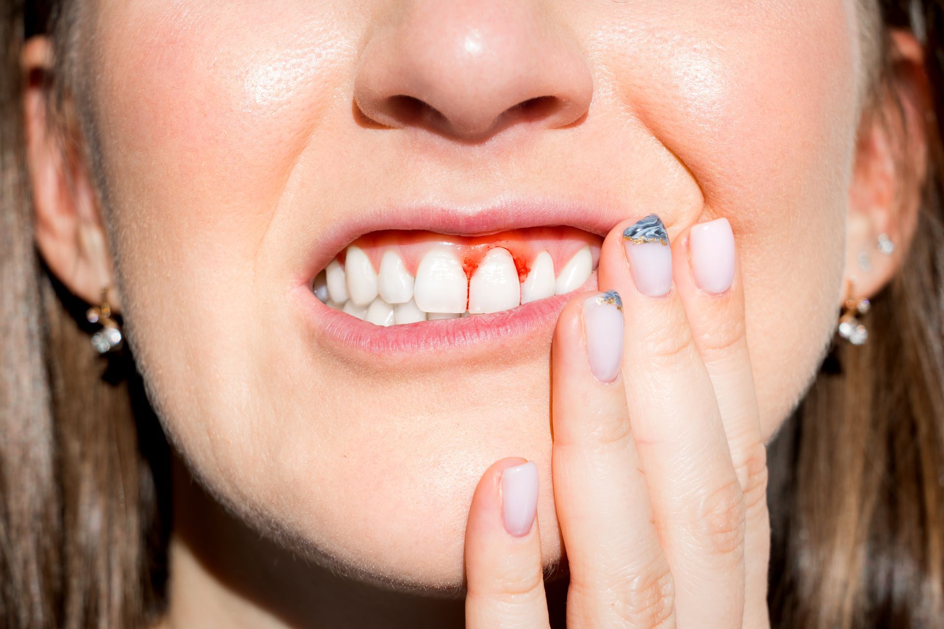Close-up of a person touching a visibly chipped front tooth with a hand