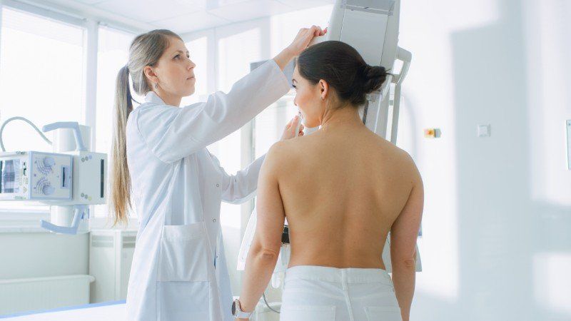 Una donna si sottopone a una radiografia del seno da parte di un medico.