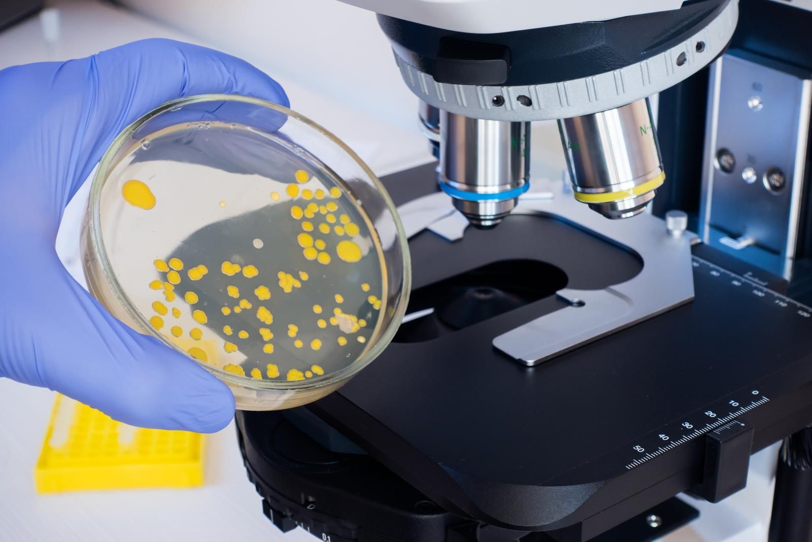 A close-up of a scientist holding a petri dish with bacteria on the background of a microscope. 