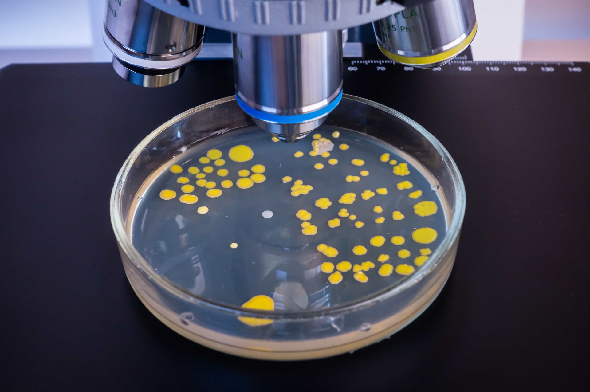 microscope with dish with yellow bacteria