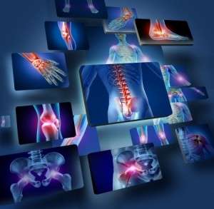 Using a Life Care Planner in Spinal Cord Injury Cases