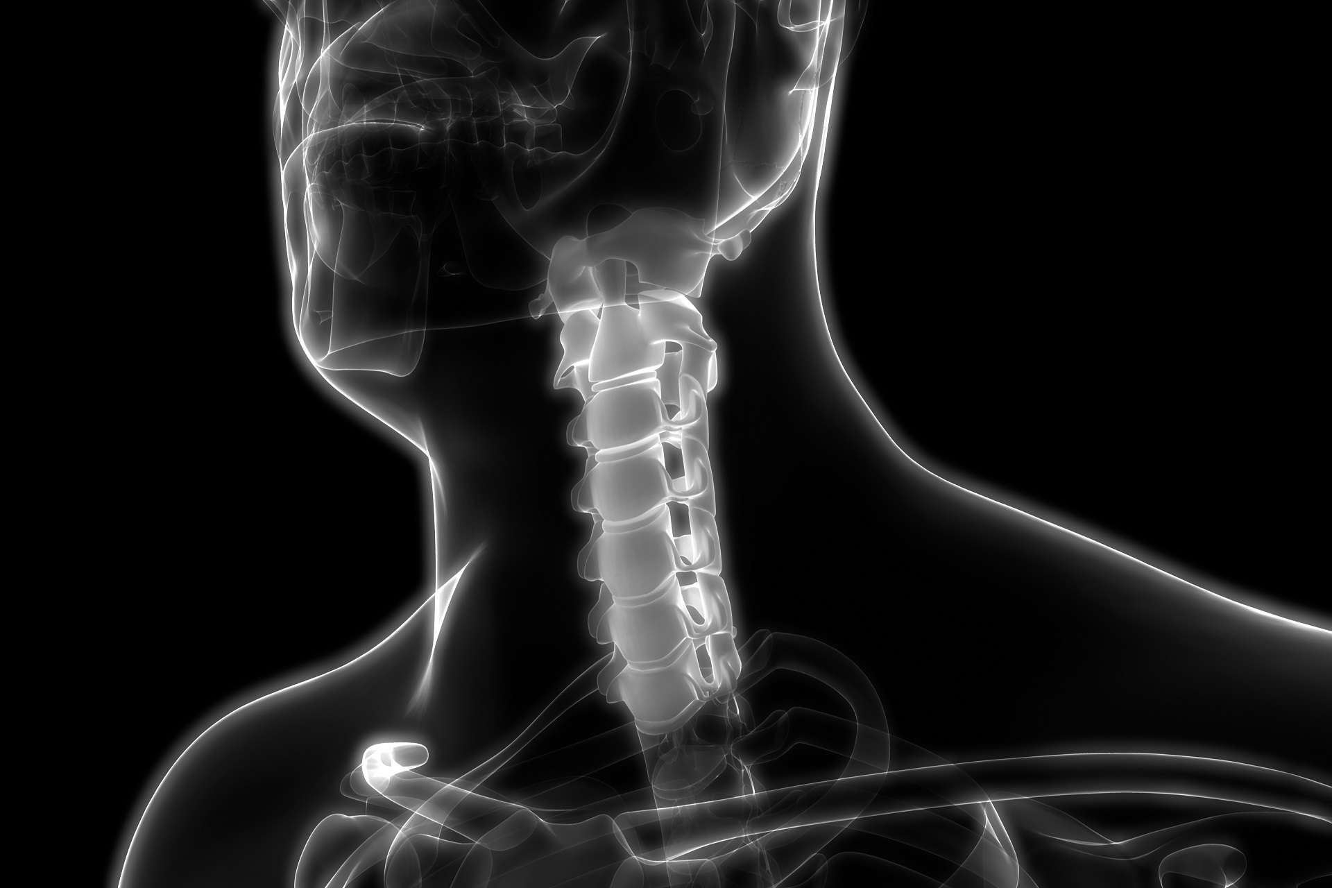 cervical spine injuries and the role of vocational experts
