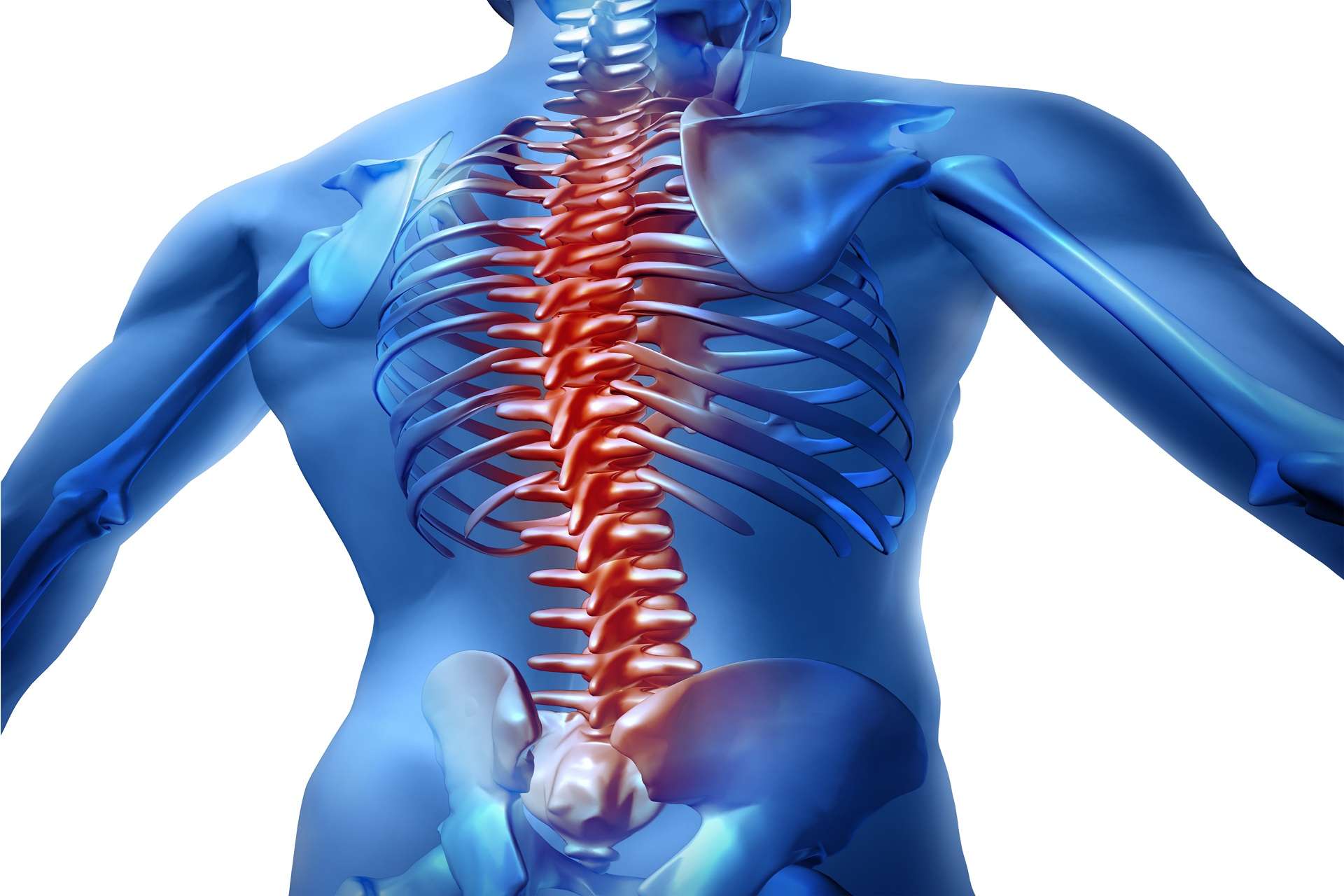 Spinal Cord Stimulator: What to Expect in Medical Bills