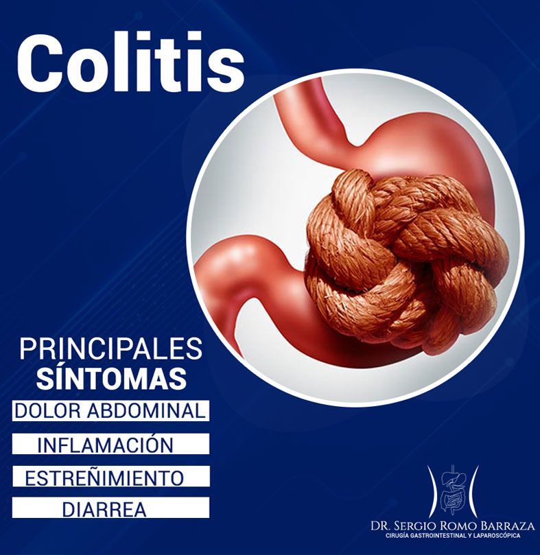Tratamiento de colitis