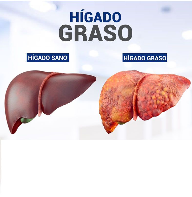 Cirugía gastrointestinal