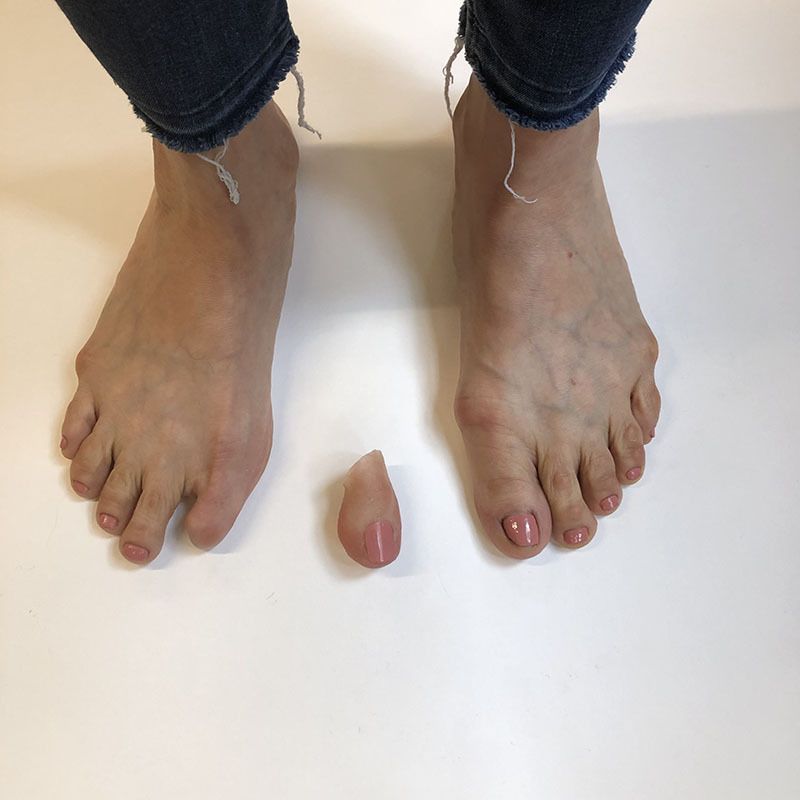 Prosthetic Silicone Skins Gallery | Prosthetics in Motion