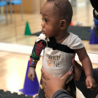 Pediatric Prosthetics NYC | Custom Limbs for Kids of All Ages