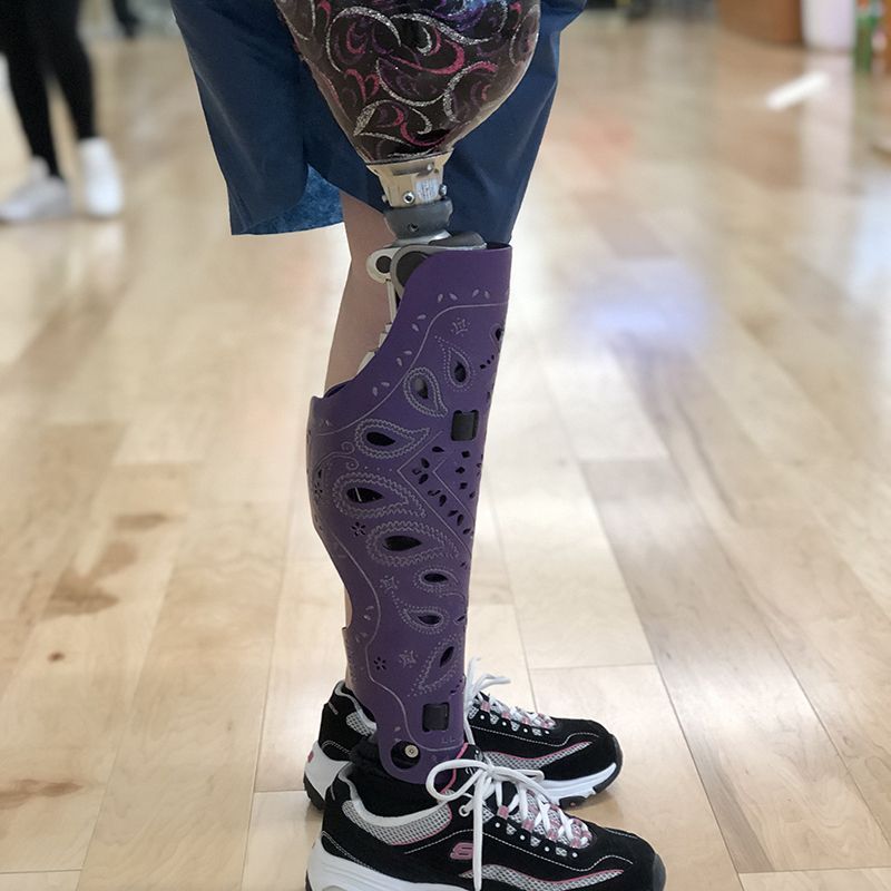 A person with a prosthetic leg is wearing purple shoes