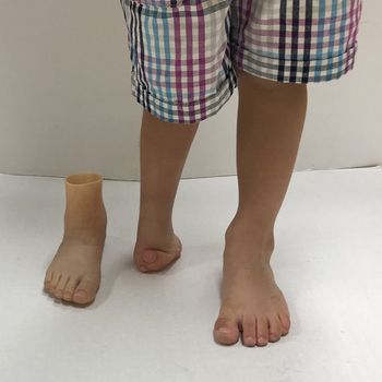 A person with a prosthetic leg and a bare foot.