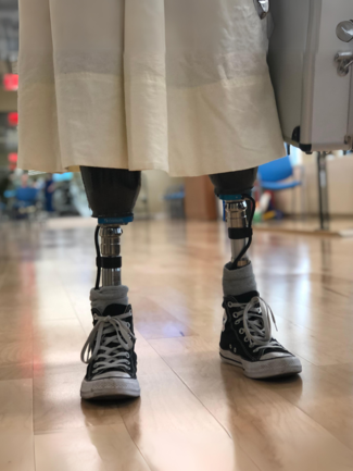 A person with a prosthetic leg wearing converse shoes.