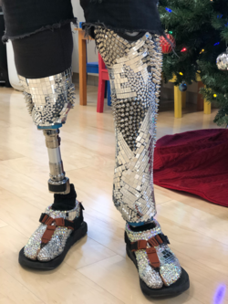 A person with a prosthetic leg is wearing sandals