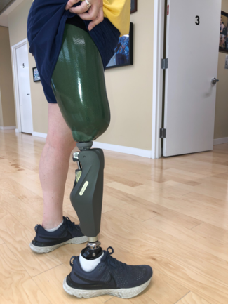 A person with a prosthetic leg is standing in front of a door with the number 3 on it