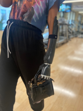 A person with a prosthetic arm is holding a black bag