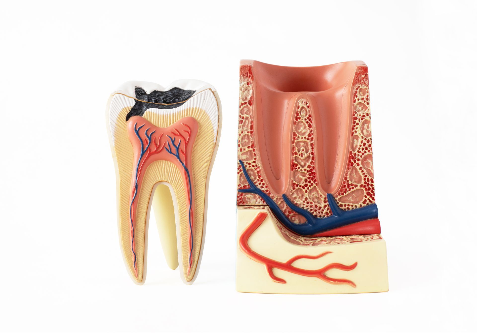 Treat gum disease and pain with ozone therapy. Inside of tooth | Ozone Therapy can treat gum disease | Therapy in Somerset, NJ 08873