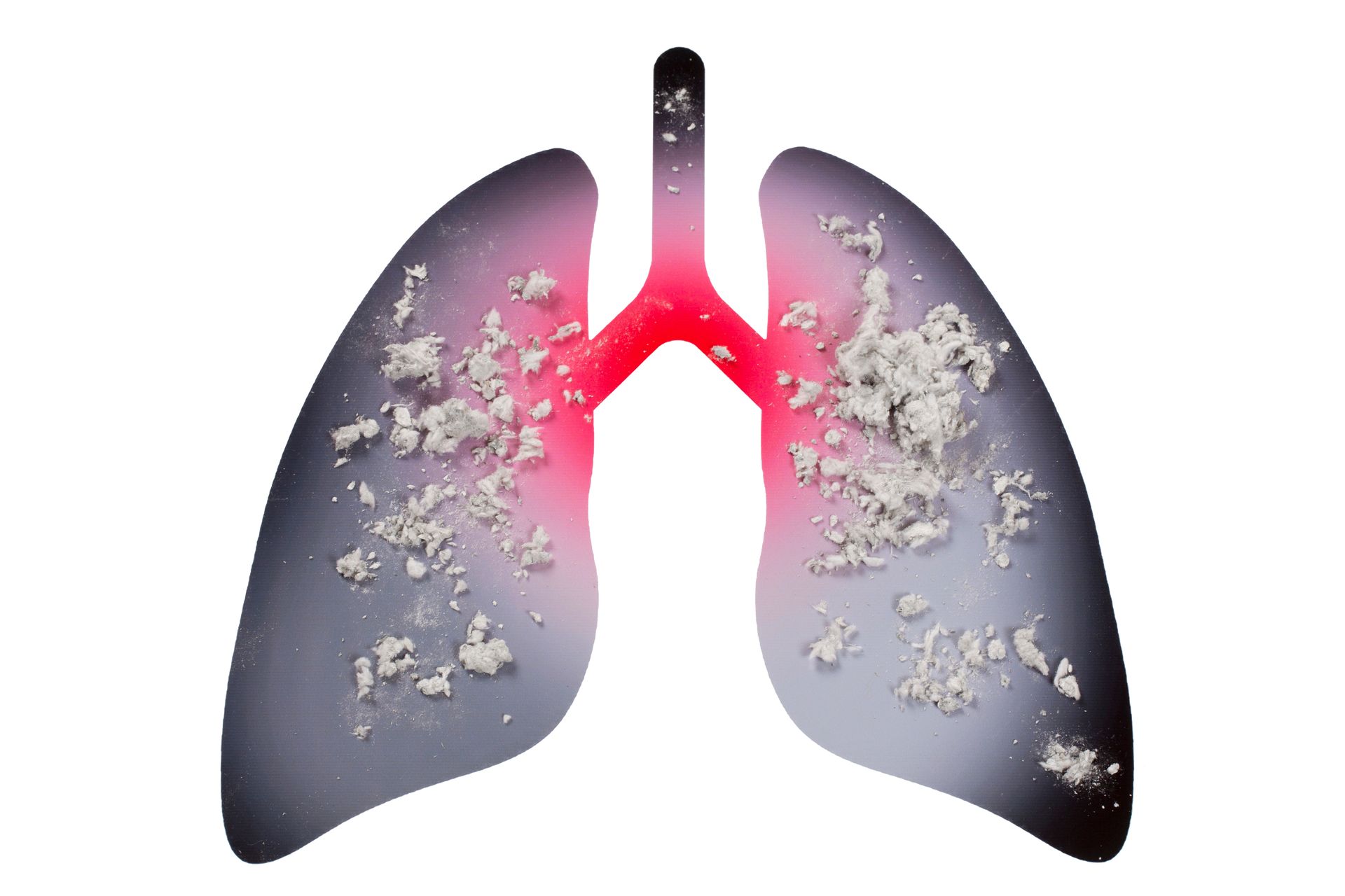 Poumons présentant une accumulation blanche, suggérant une lésion pulmonaire. Le rouge met en évidence la trachée