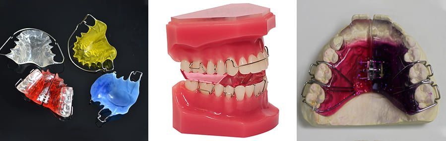 Types Of Removable Orthodontic Appliances Types Of Removable Orthodontic Appliances
