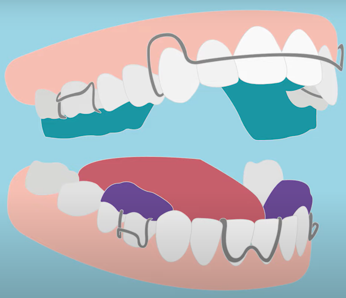 Diagram Of Teeth Diagram Of Teeth