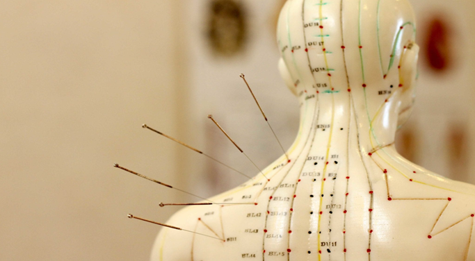 Mannequin with acupuncture needles inserted at various points on the back.