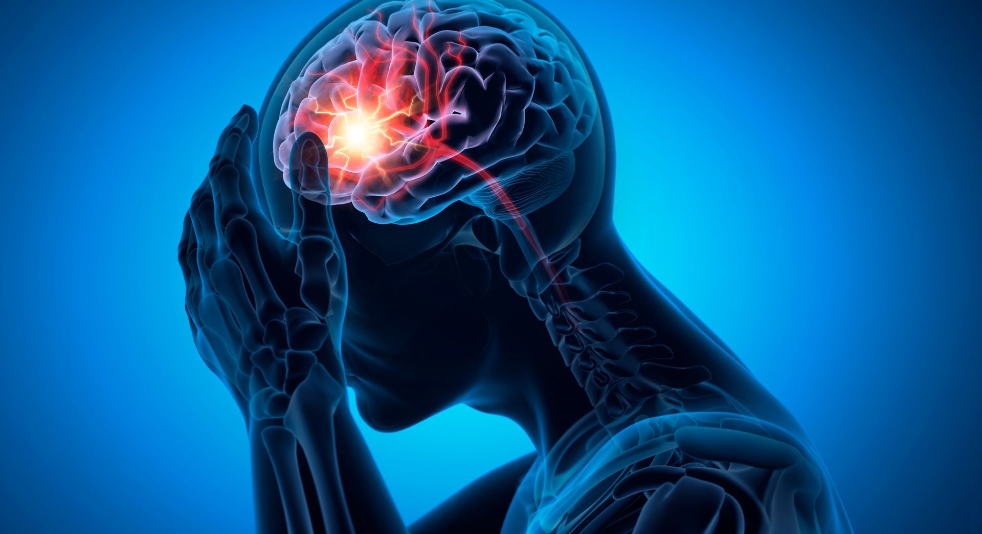 X-ray view of person with highlighted brain and headache.