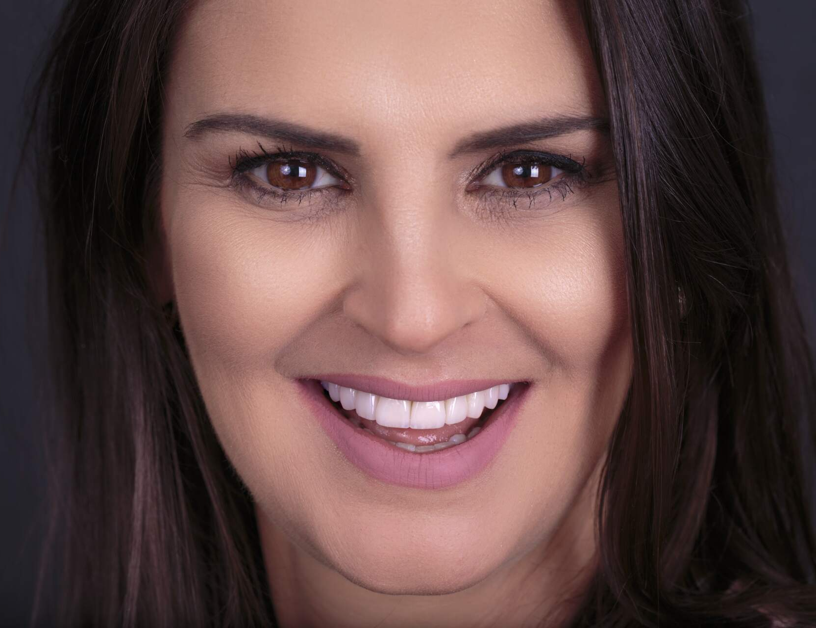 lentes de contato dental prodonto