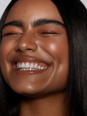invisalign prodonto