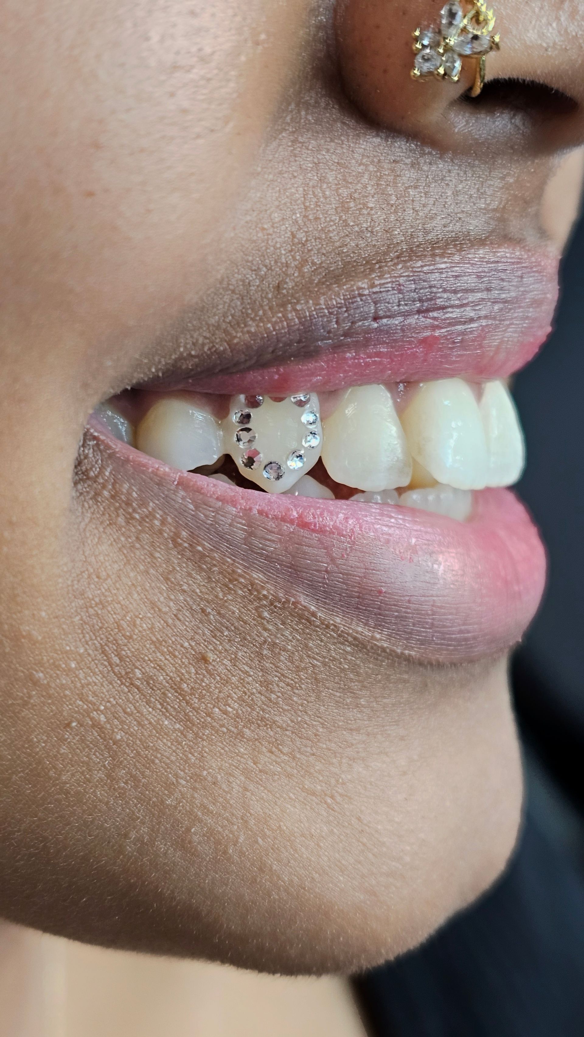 Professional tooth gem application at Ikonik Ink, Lakewood CO