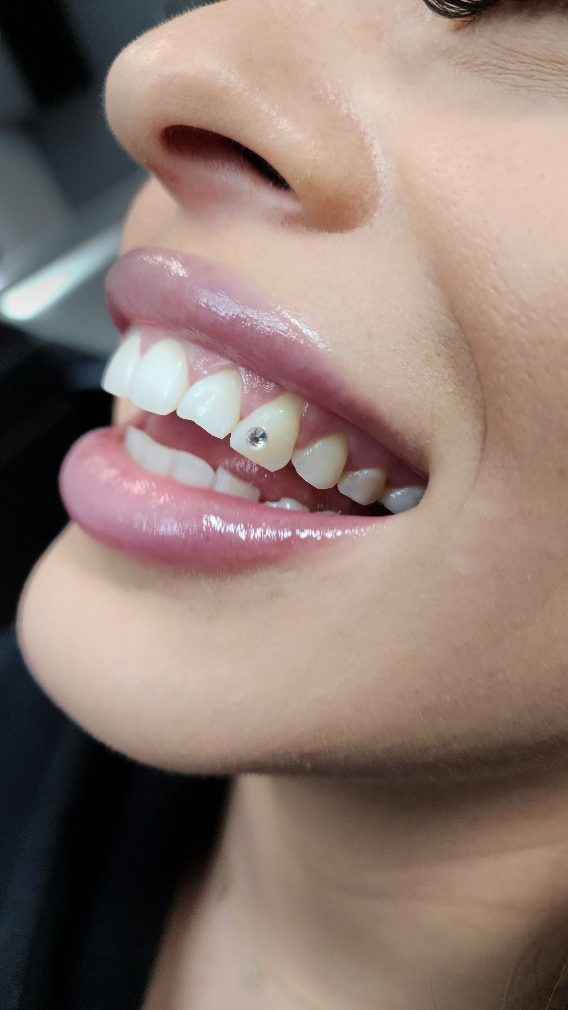 Crystal tooth gem applied to a tooth at Ikonik Ink in Lakewood, CO