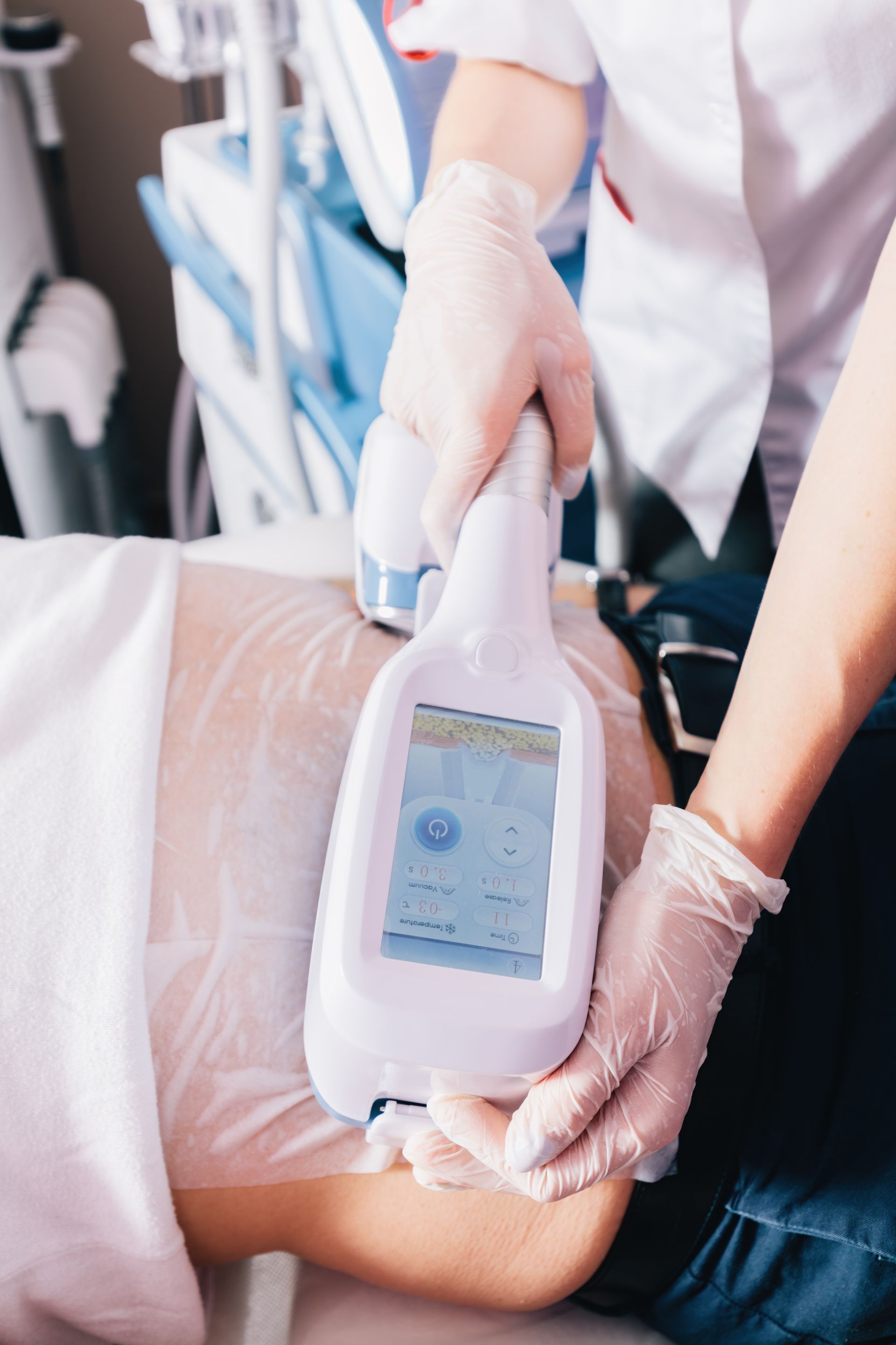 a woman is getting a treatment with a device that says ' sd ' on it