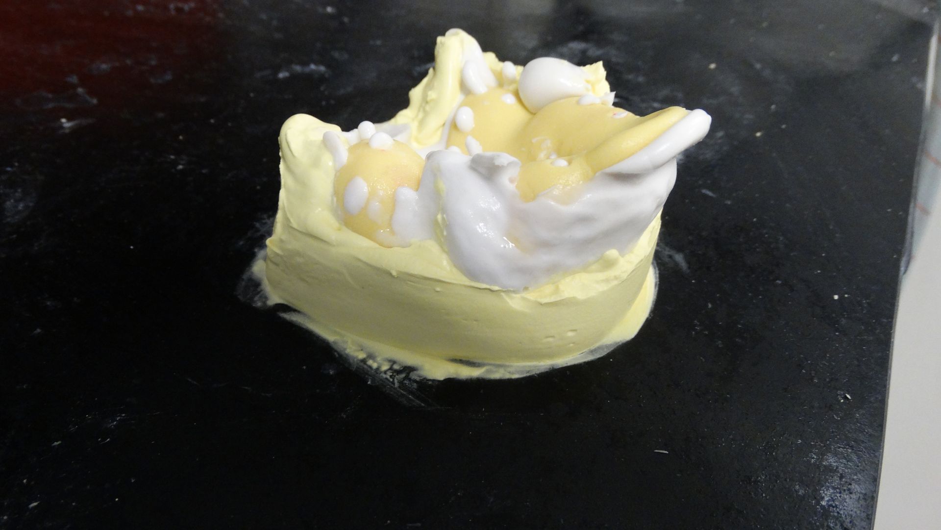 Impression Poured Up — Batehaven, NSW — Keen Dentures