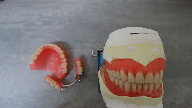 Wax Try-ins — Batehaven, NSW — Keen Dentures