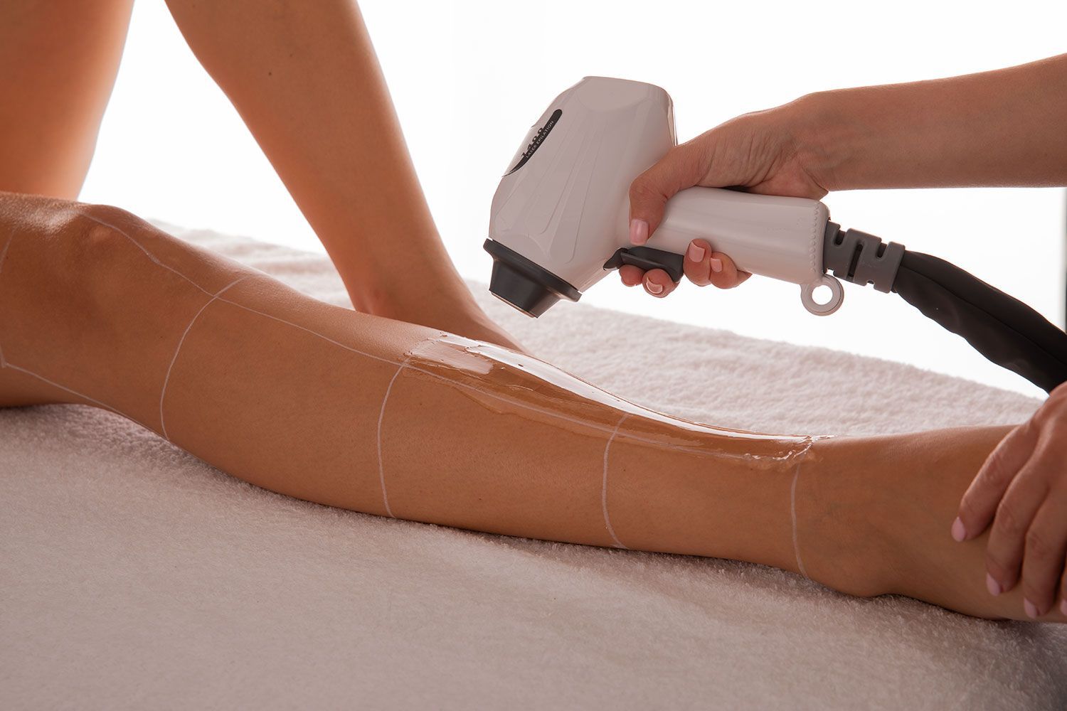 epilazione laser