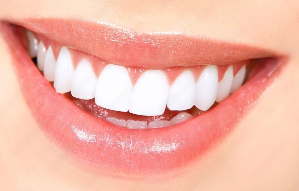 A close up of a woman 's smile with white teeth.