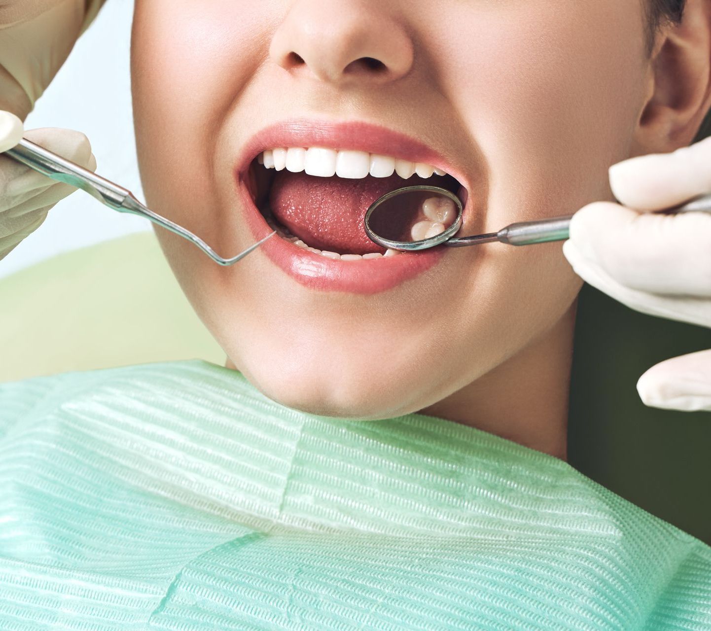 Composite Fillings | Morgantown WV Dentist A woman is getting her teeth examined by a dentist