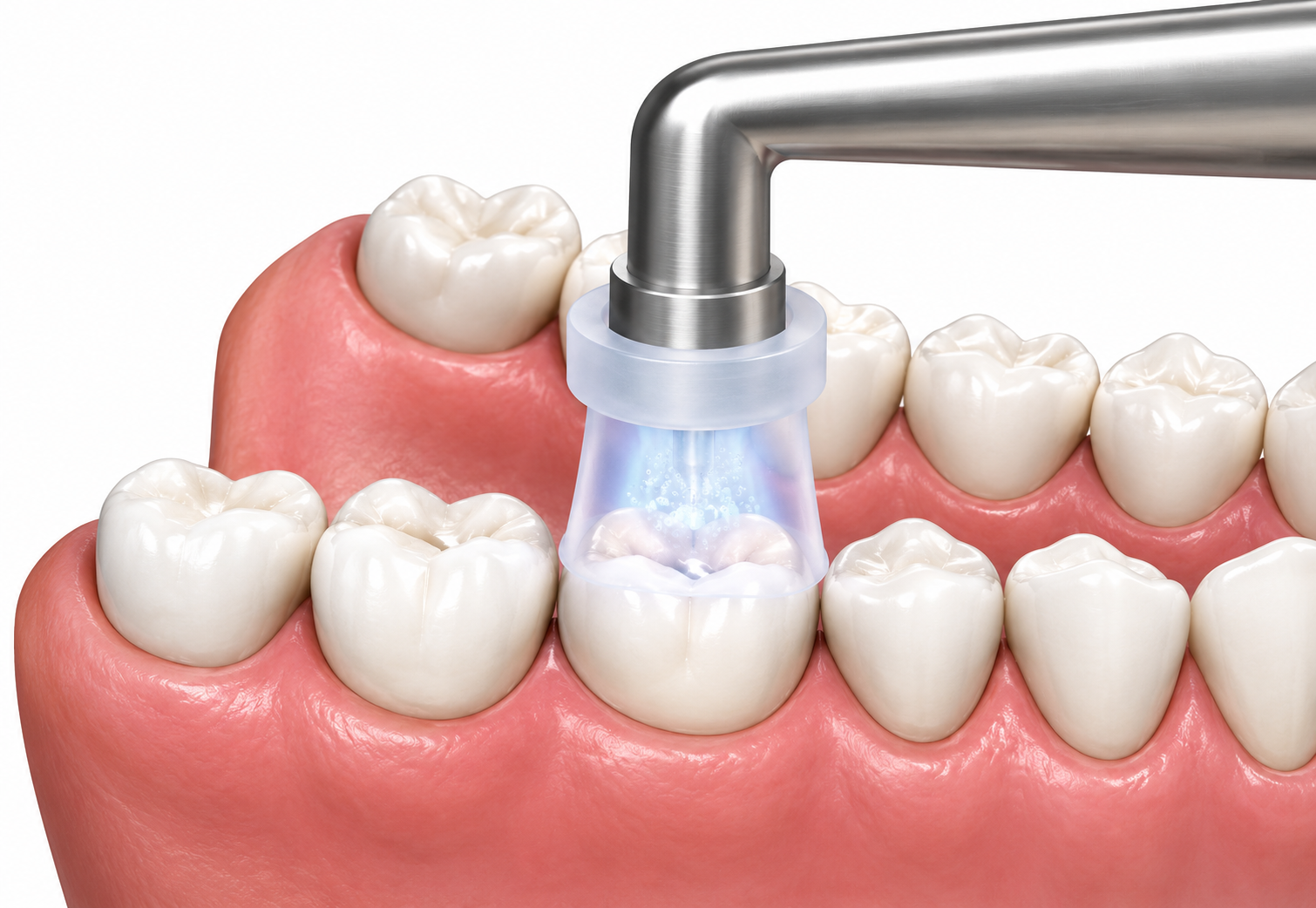 Dental cleaning tool spraying water on a tooth in a pink mouth model