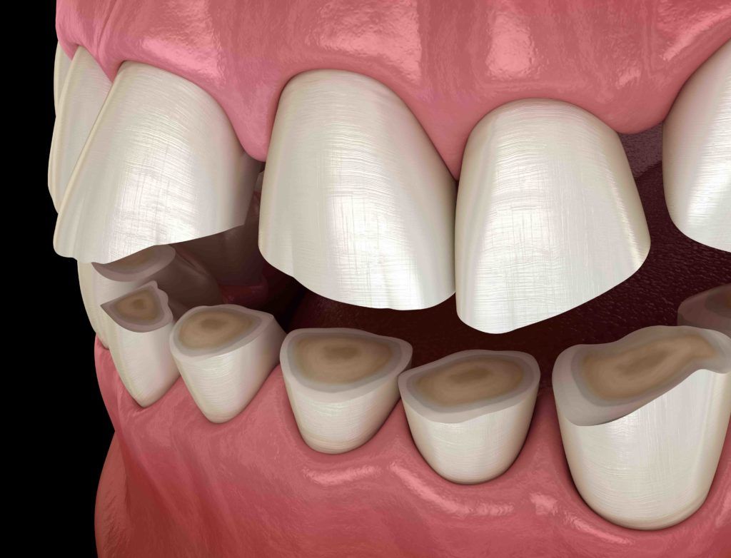 A close up of a person 's teeth with a black background