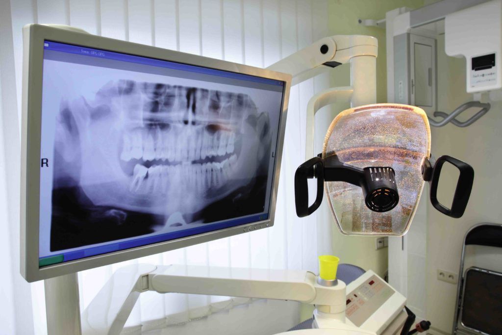An x-ray of a person 's teeth is on a monitor in a dental office.