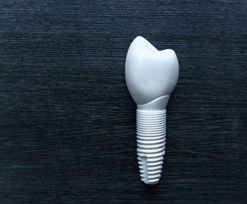 A model of a dental implant on a black surface.