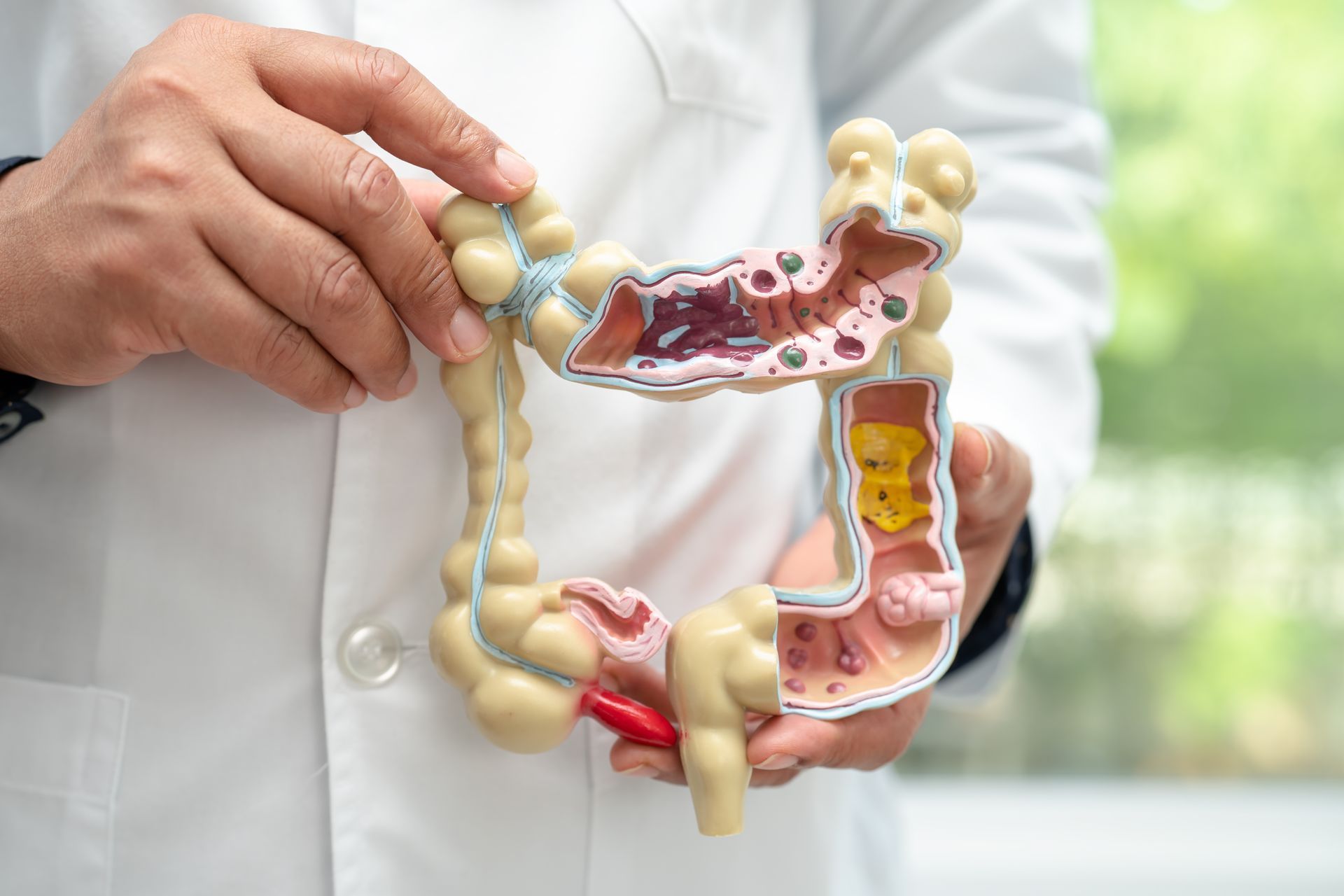 Doctor holding a detailed colon anatomy model in a white coat