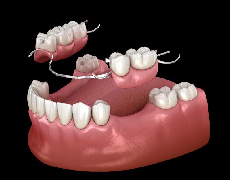 A computer generated image of a denture on a black background.