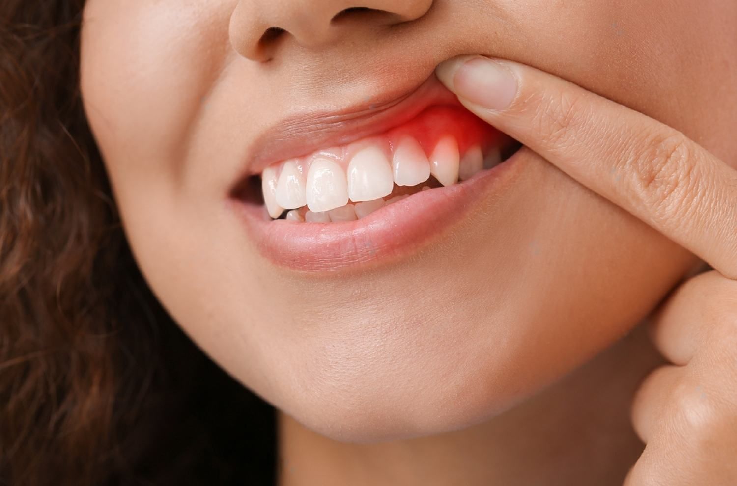 A close up of a woman 's mouth with a toothache.