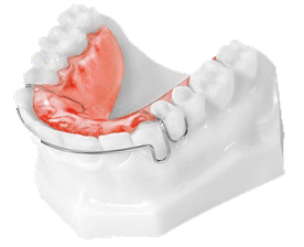 Retainers