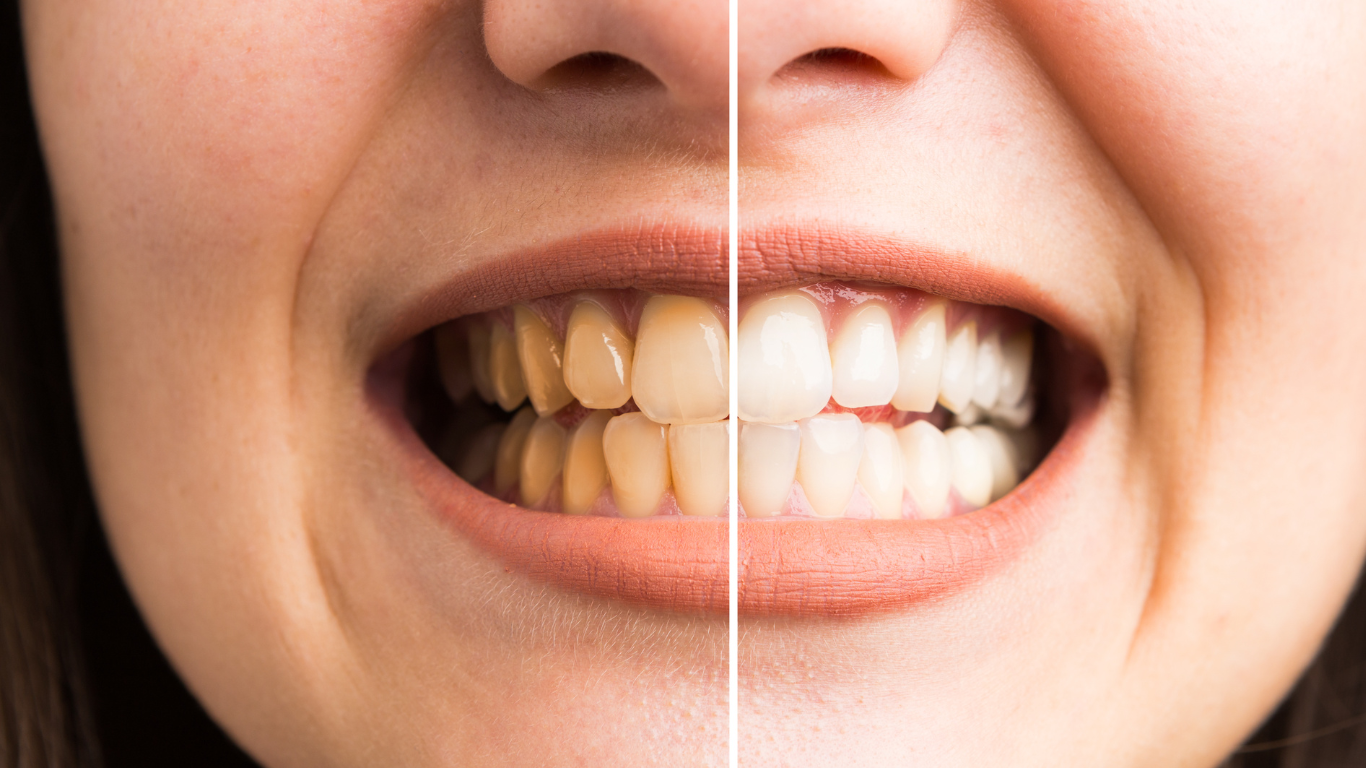 Ästhetik & Smile-Design Bern