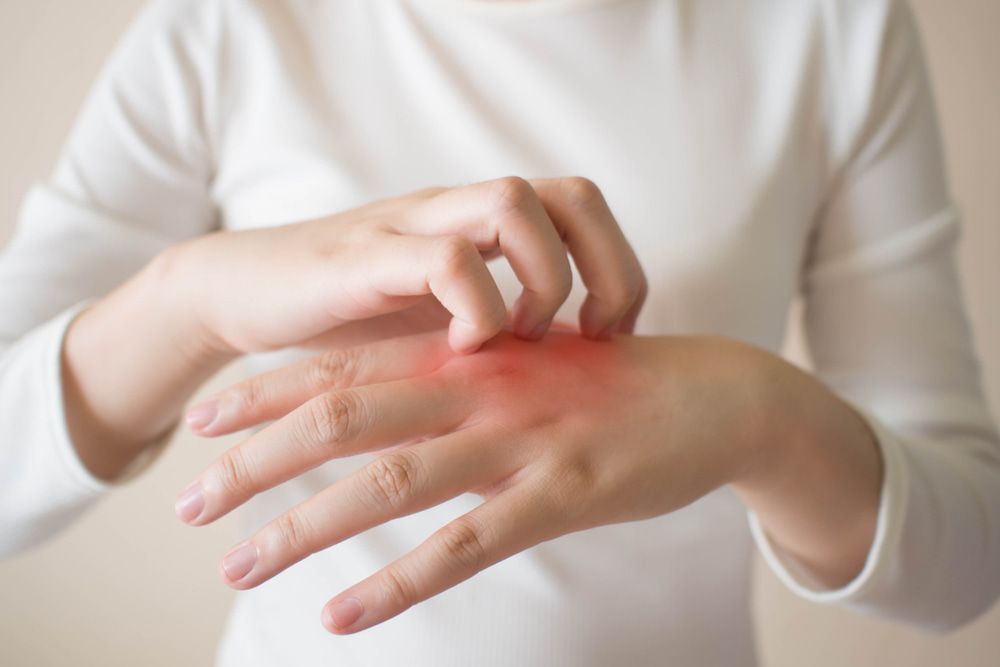 A Woman Is Scratching Her Hand With A Red Spot On It — Naturopath Australia In Mermaid Beach, QLD