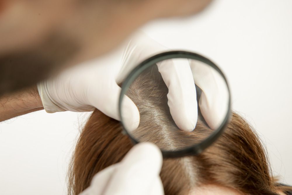 A Person Looking At A Woman 's Hair Through A Magnifying Glass— Naturopath Australia In Mermaid Beach, QLD