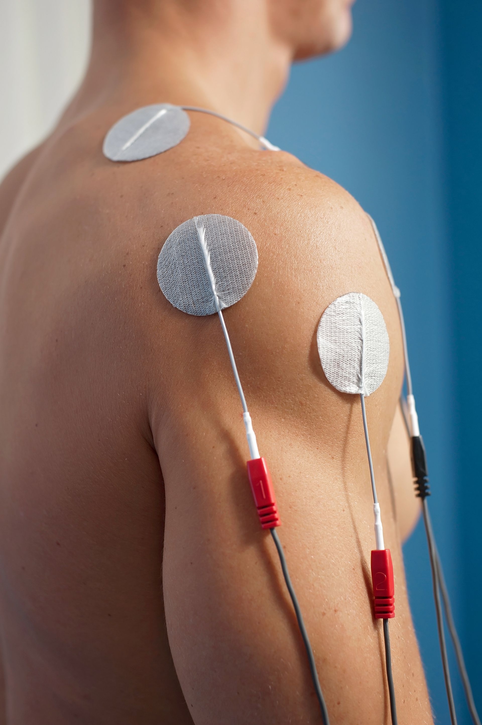 A man is getting electrodes applied to his shoulder