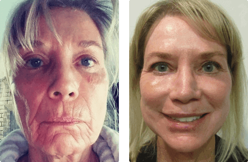 Connie Sarkisian — Dearborn, MI — Masri Clinic