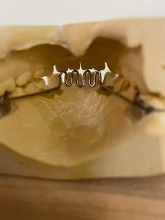 A close up of a dental model with braces on it.