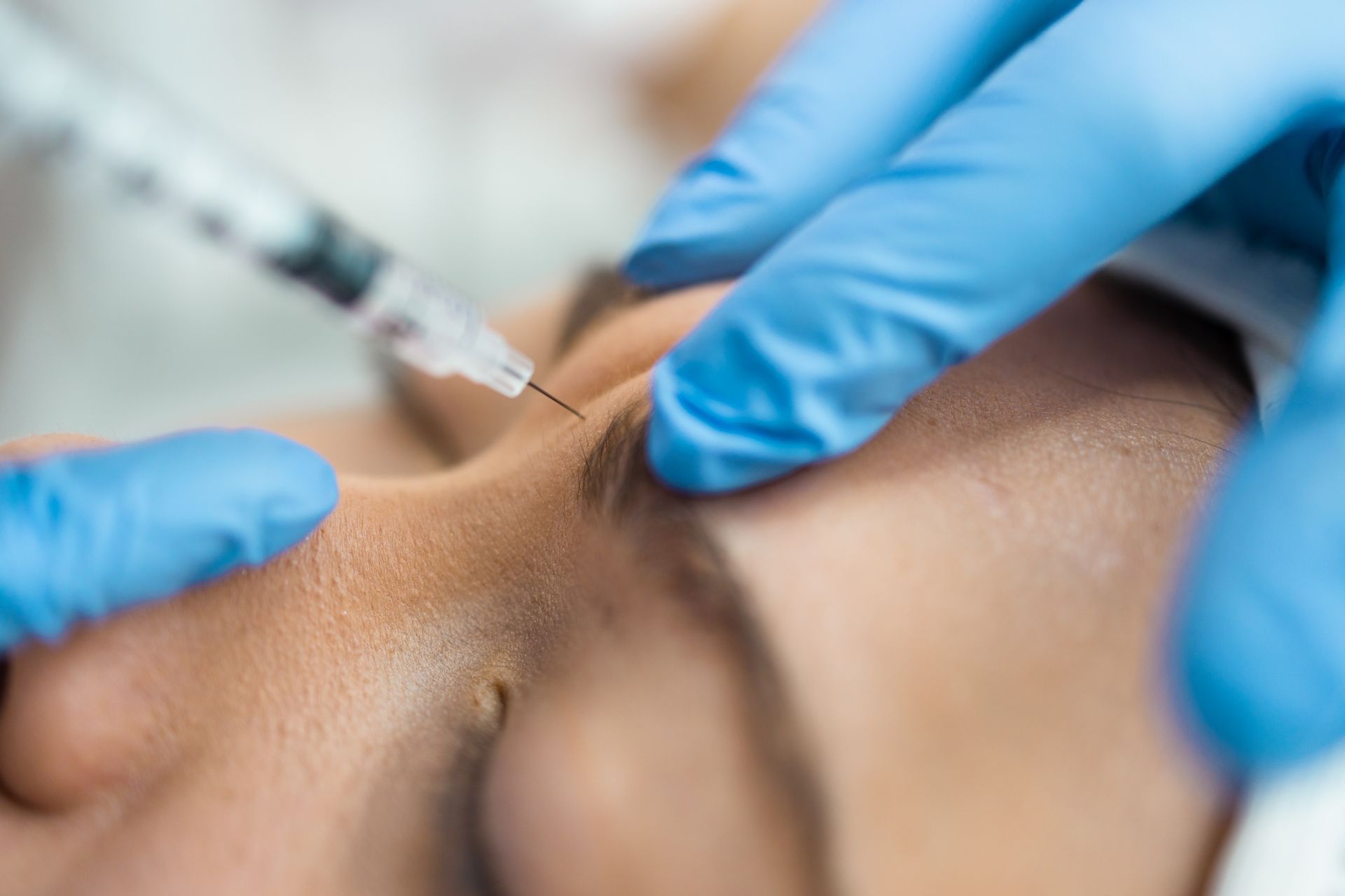 Botox Injections