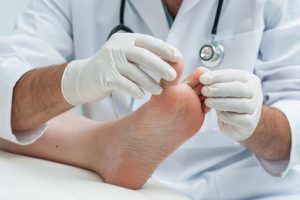 LapiFuse procedure