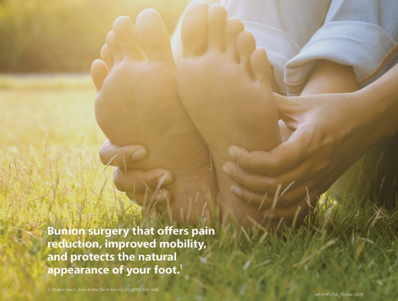 Lapiplasty® 3D Bunion Correction